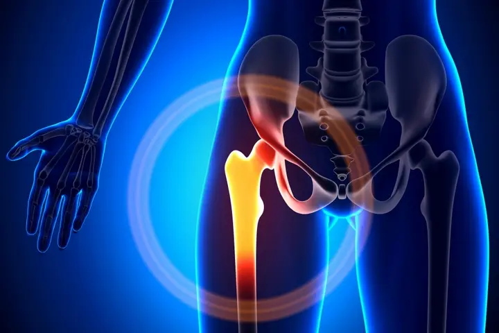 Anatomy20of20the20 Hip20 Joint20and20 Its20 Connection20to20 Surrounding20 Structures resized