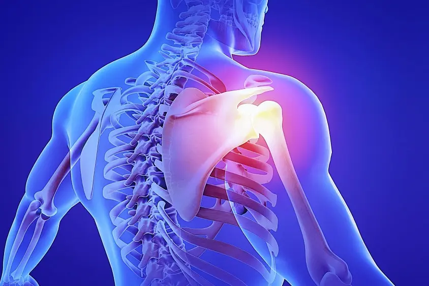 MOVEPRO_Ben_Frozen_Shoulder_News