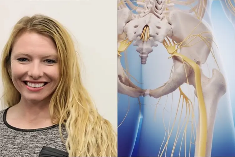 KD_Sciatica_MOVEPRO_News