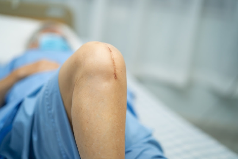 AT_Dissection_Livestream_TKA_News