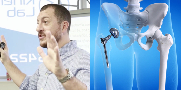 股関節OAの管理と人工股関節置換手術への対応