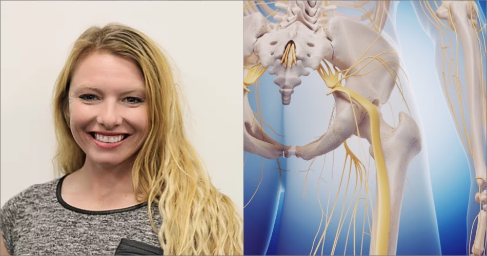 KD_Sciatica_MOVEPRO_News