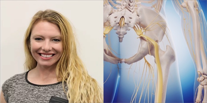 アナトミーエンジェル:坐骨神経痛を理解する