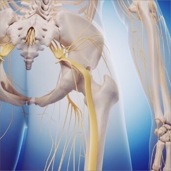 アナトミーエンジェル：坐骨神経痛を理解する