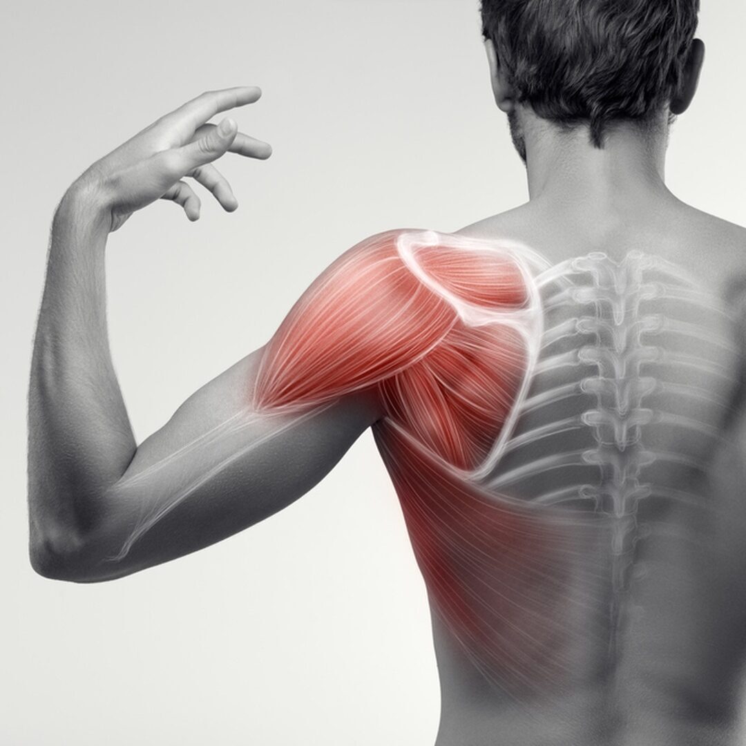 Sue Falsone Shoulder